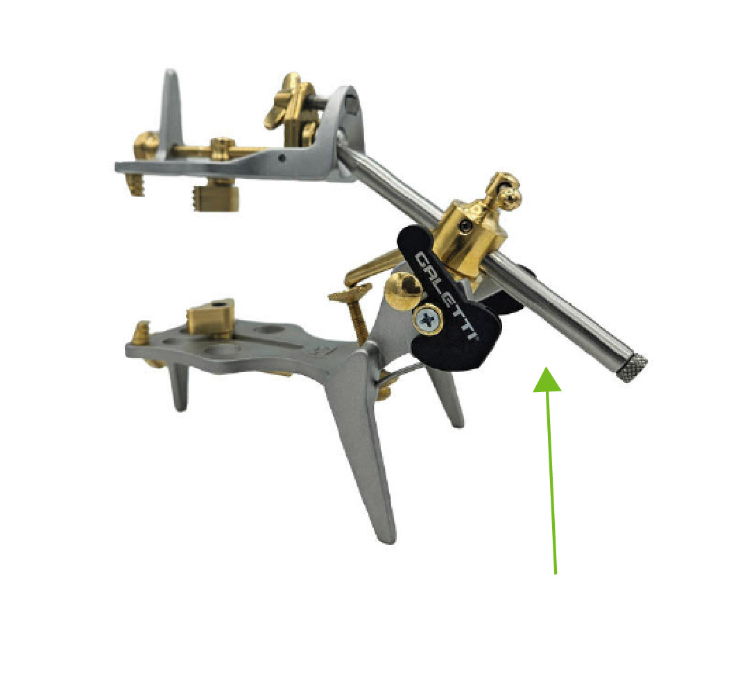 Nieuwe kogelschacht met uitneembare extensie