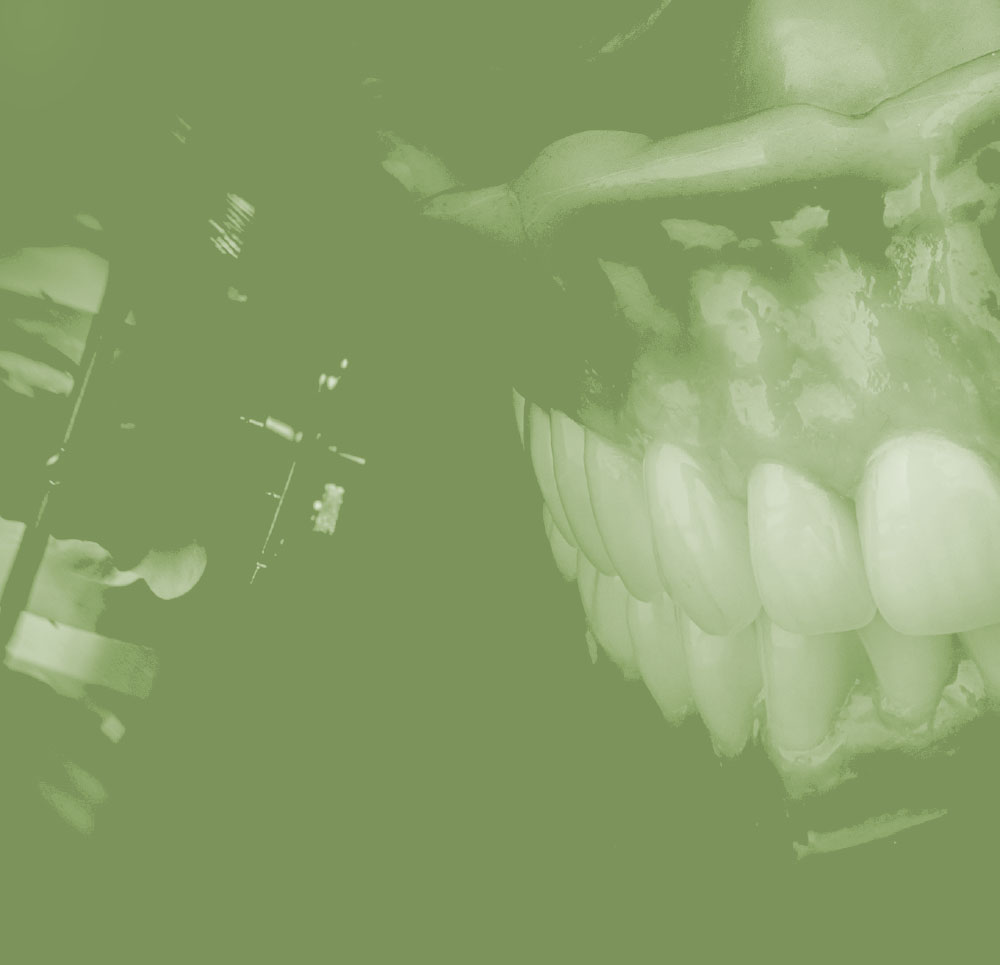 Drie hoogwaardige trainingen die perfect aansluiten bij de nieuwste ontwikkelingen binnen de tandprothetiek en tandtechniek.