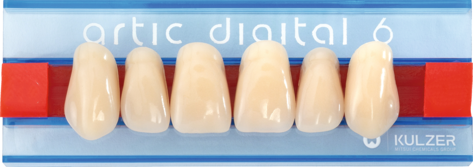 Kulzer Artic Digital Tanden boven
