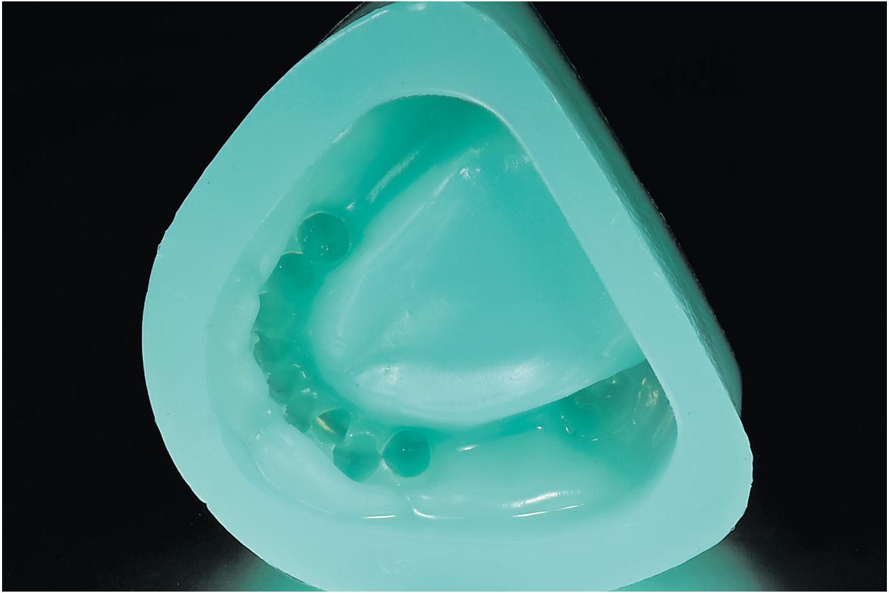 Shera Duble Dupliceergel Groen t.b.v. Inbedmassa