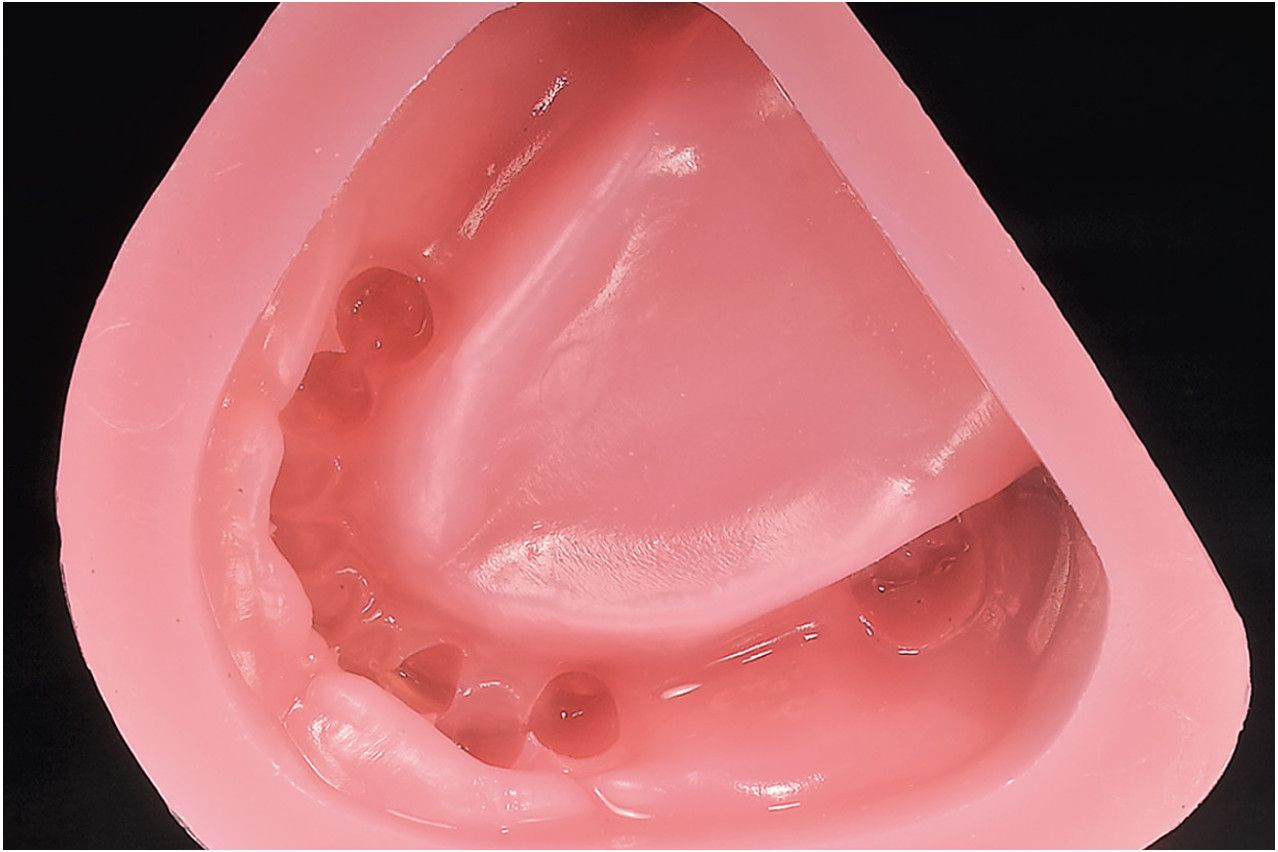 Shera Gel Dupliceergel Rood t.b.v. Inbedmassa en Kunststof