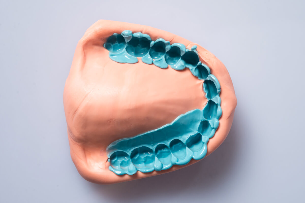 Vannini Prestige Light Fast-Set Afdruksiliconen Incl. Mixingtips